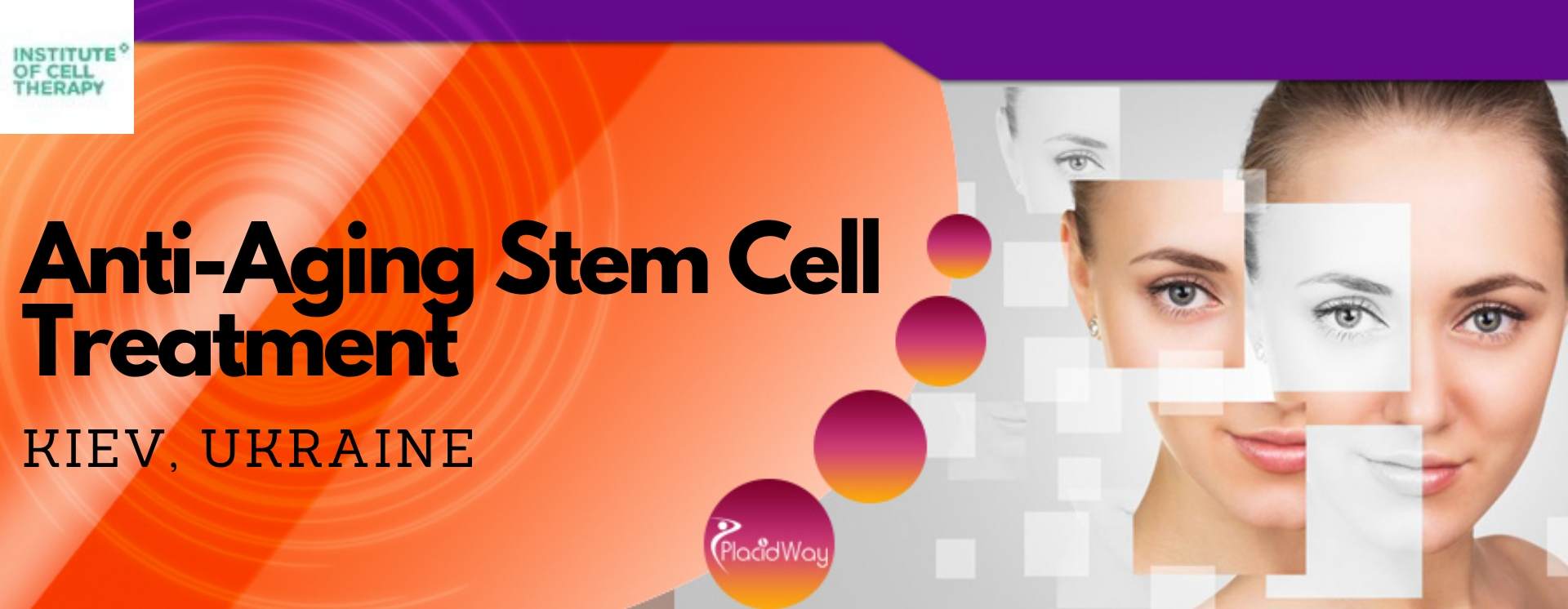 Anti-Aging Stem Cell Treatment in Kiev, Ukraine Anti-Aging Stem Cell Treatment in Kiev, Ukraine
